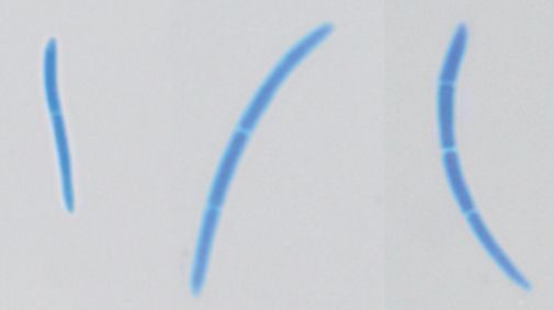 Abb. 3. Konidien von Septoria birgitae (zweizellige K.: 28,1´ 2,1 μm; dreizellige K.: 29,9´ 1,57 μm; vier­zellige K.: 32´ 1,84 μm (gefärbt mit Wittmann\qs Blau).