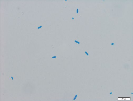 Fig. 4. Conidia (stained with Wittmann’s Blue).