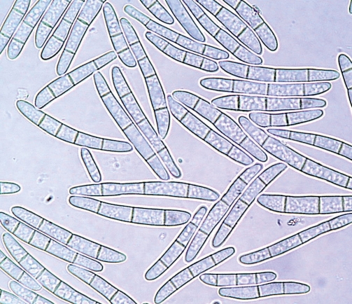 Abb. 8. Makrokonidien der Cylindrocarpon-Anamorphe 
(Befallsfläche bei Seddin). Bildautoren: P. Hey­deck, R. Merkel

