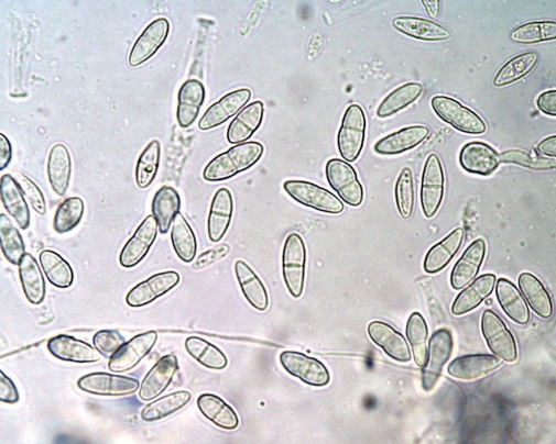 Abb. 11. Ascosporen von Neonectria neomacrospora im mi­kroskopischen Präparat 
(Befallsfläche bei Seddin). Bildautoren: P. Heydeck, R. Merkel
