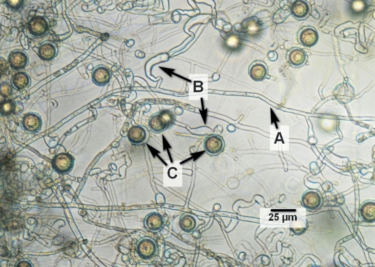 Fig. 2.  Microscopic image of the isolate from Lemna minor on PDA50%.
 A: unseptate hyphae, B: ir­regularly shaped, elong­ated appressoria, C: aplerotic oospores.
